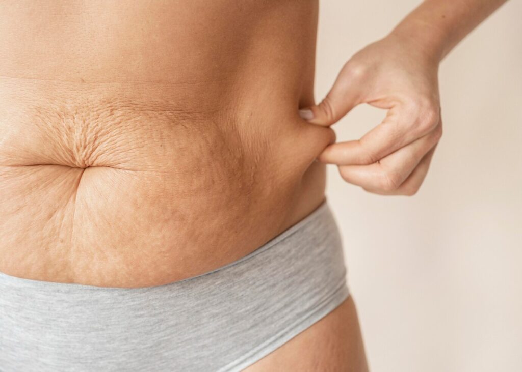 What is Adipose Tissue?