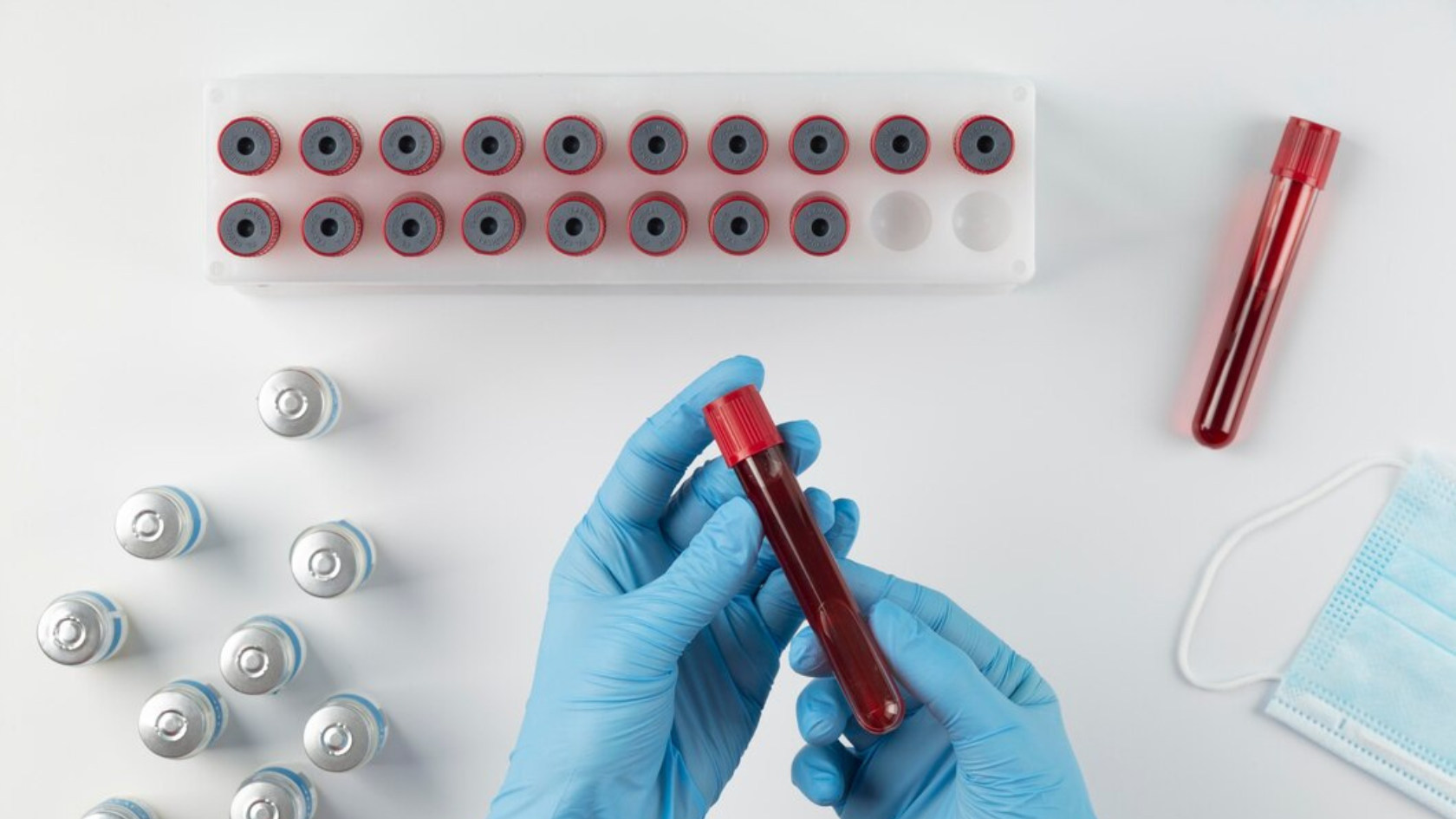 What Is Serum Testosterone?