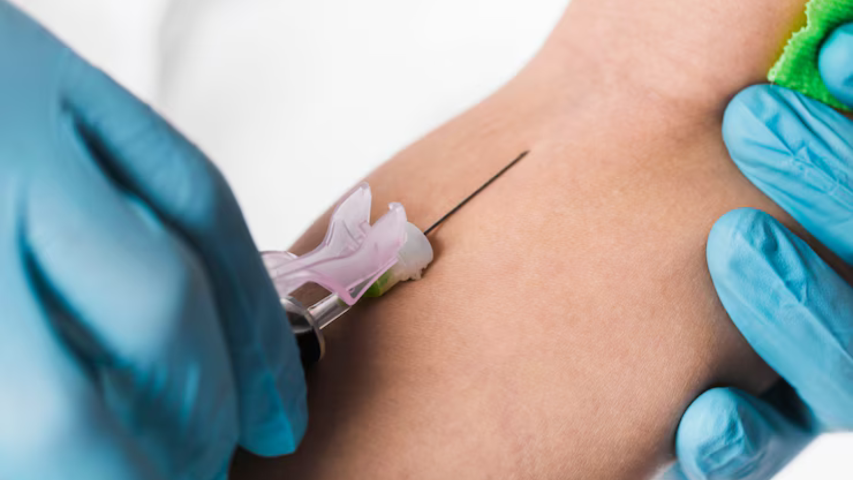 What Is a Peripheral IV Catheter? - Orion Health & Wellness Services
