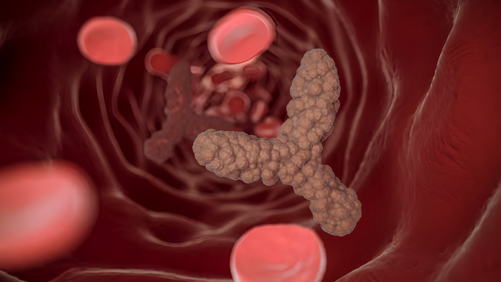 What Is Cholecystokinin (CCK)?