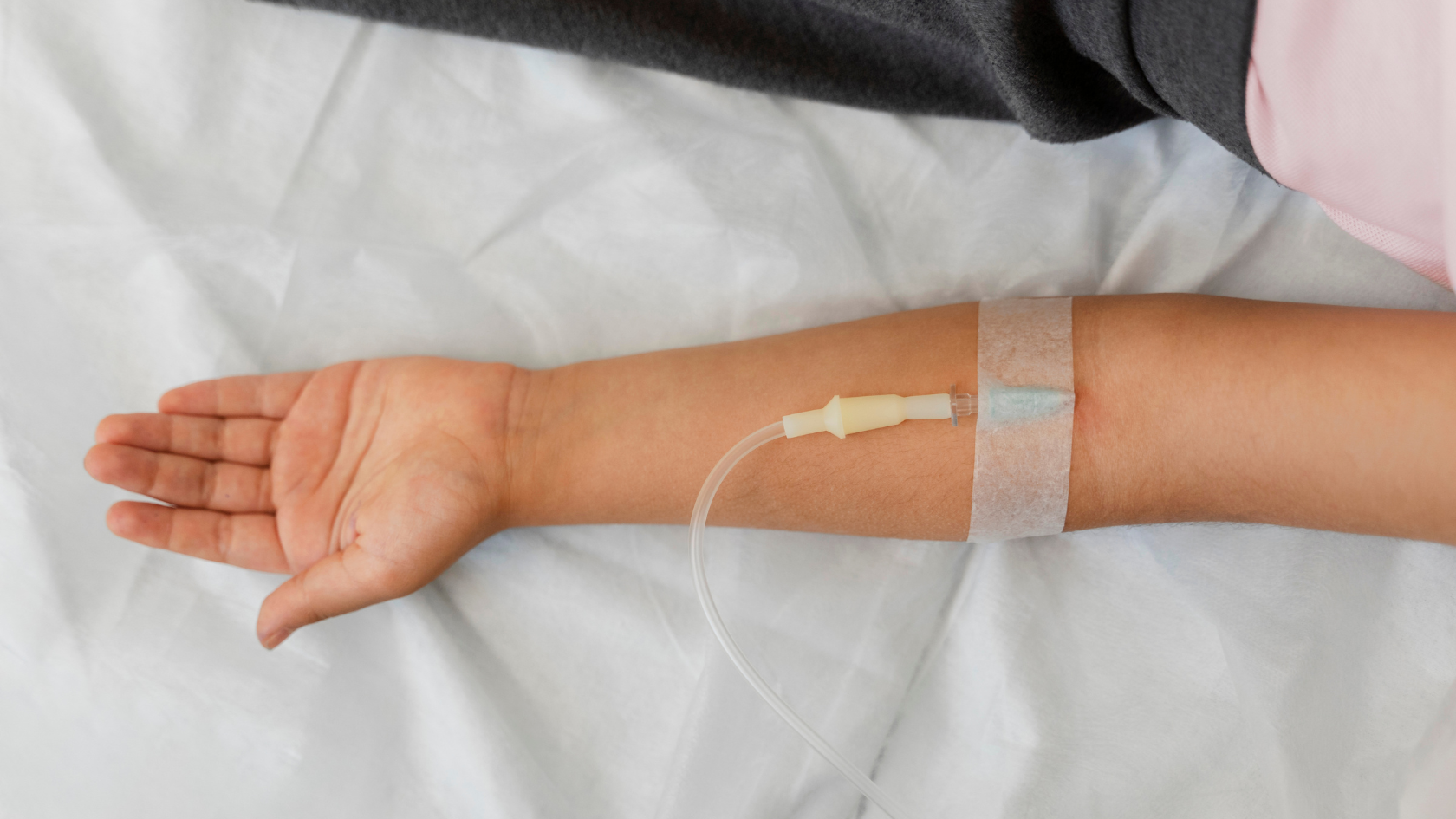 What is Intermittent infusion?